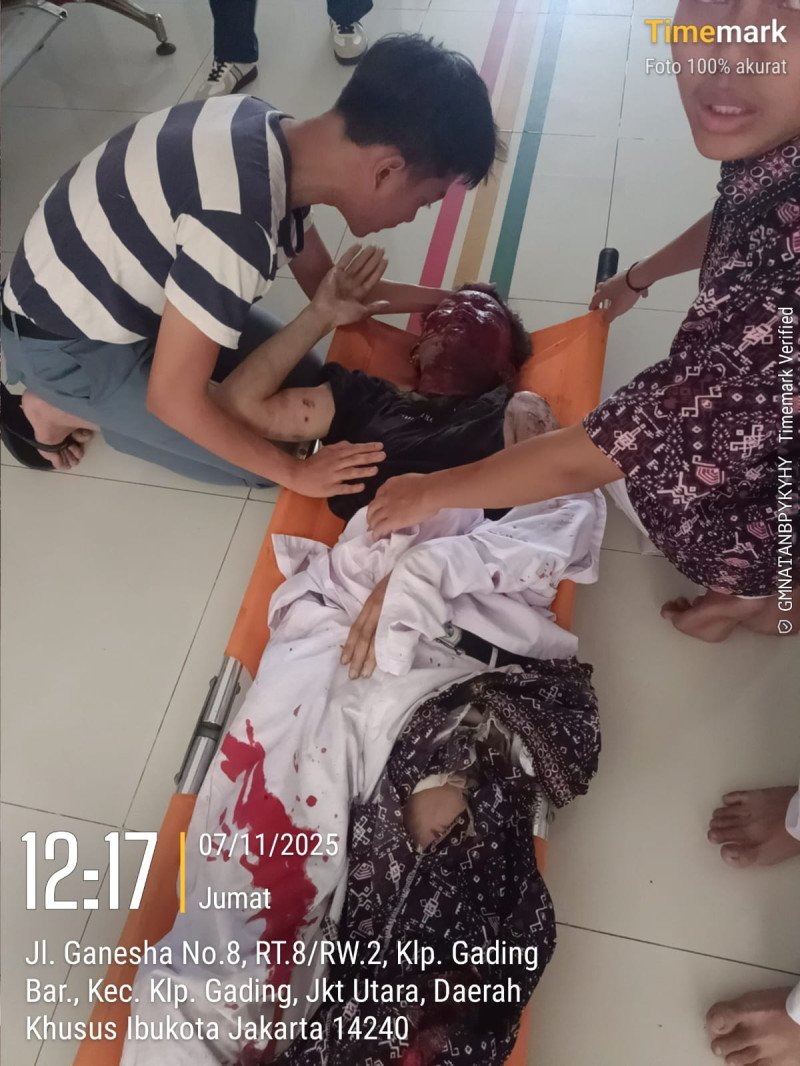 Ledakan Guncang SMA Negeri 72 Jakarta, Delapan Siswa Luka-Luka