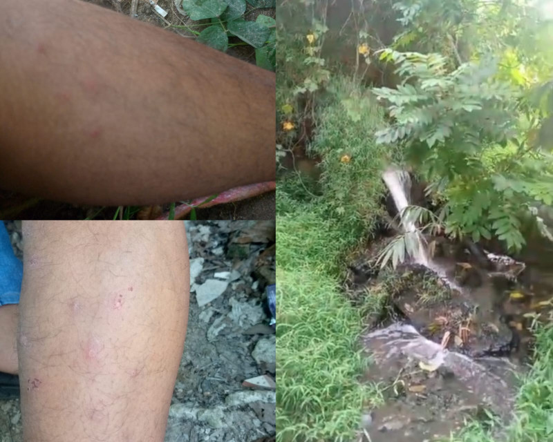 Diduga Limbah PTPN III Gunung Para Dolok Merawan Cemari Sungai Bahilang, Warga Terserang Penyakit Gatal